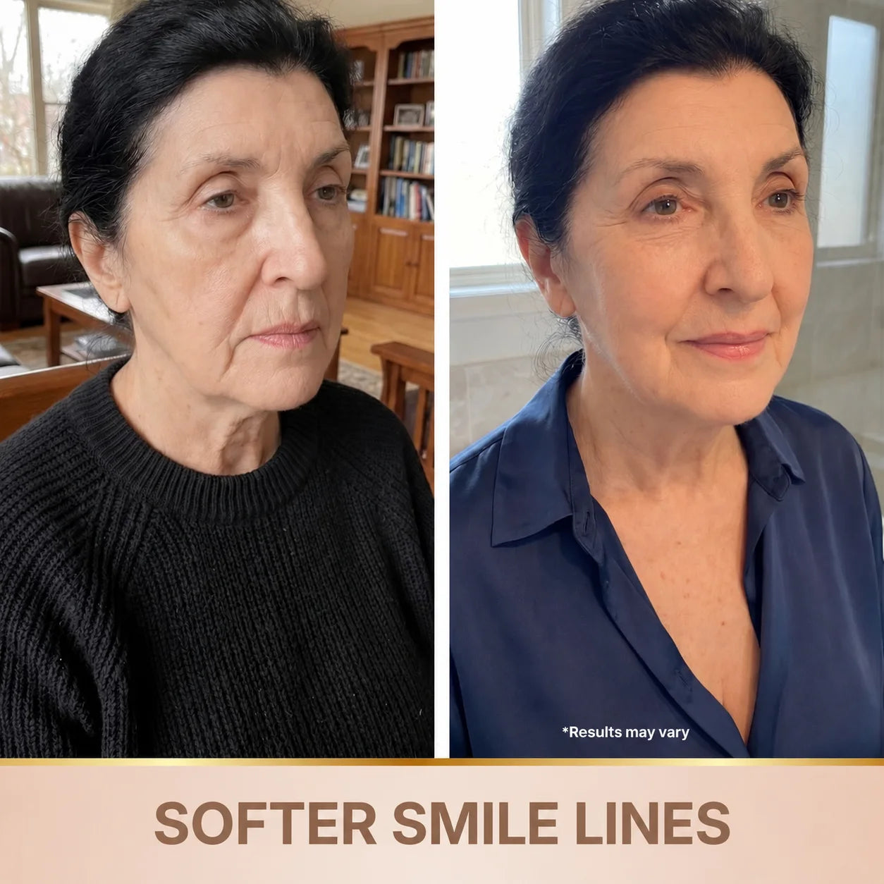 SOELY Korean serum