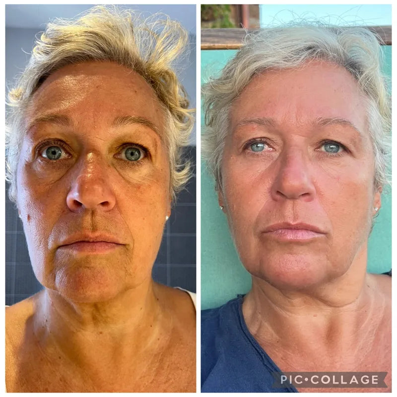SOELY Korean serum