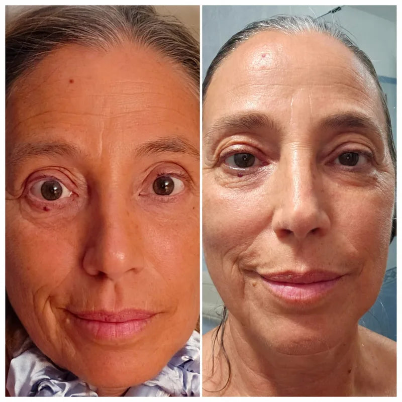 SOELY Korean serum