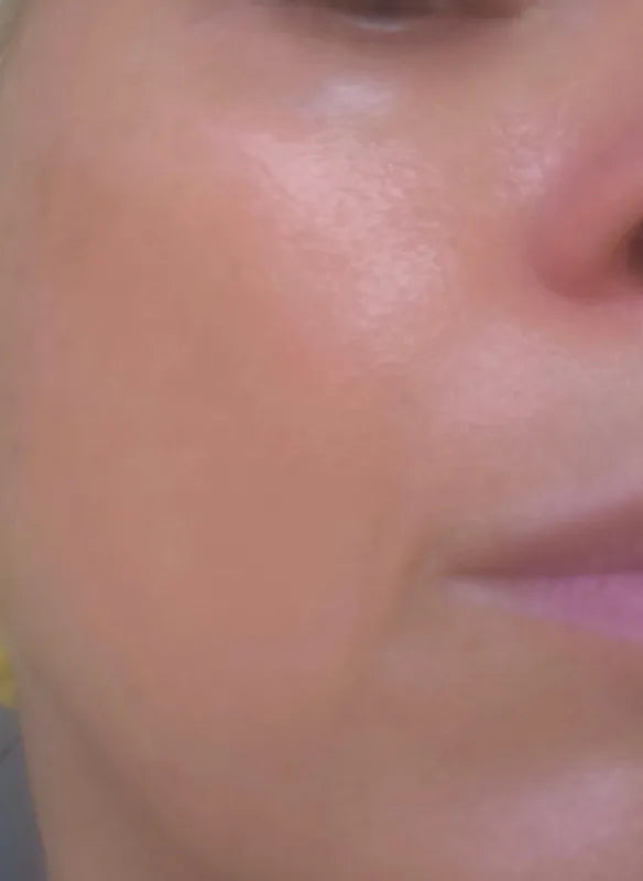 SOELY Korean serum