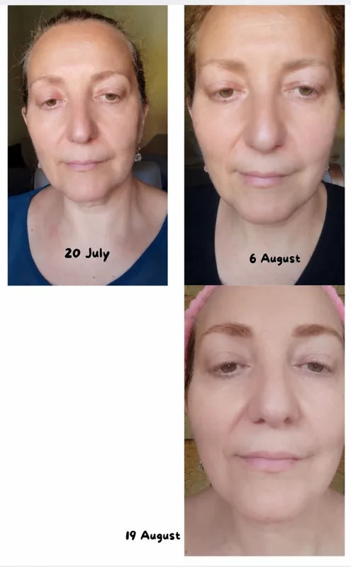 SOELY Korean serum